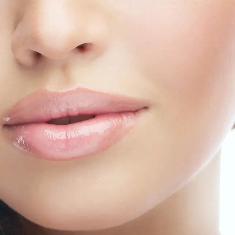 Dermal Fillers