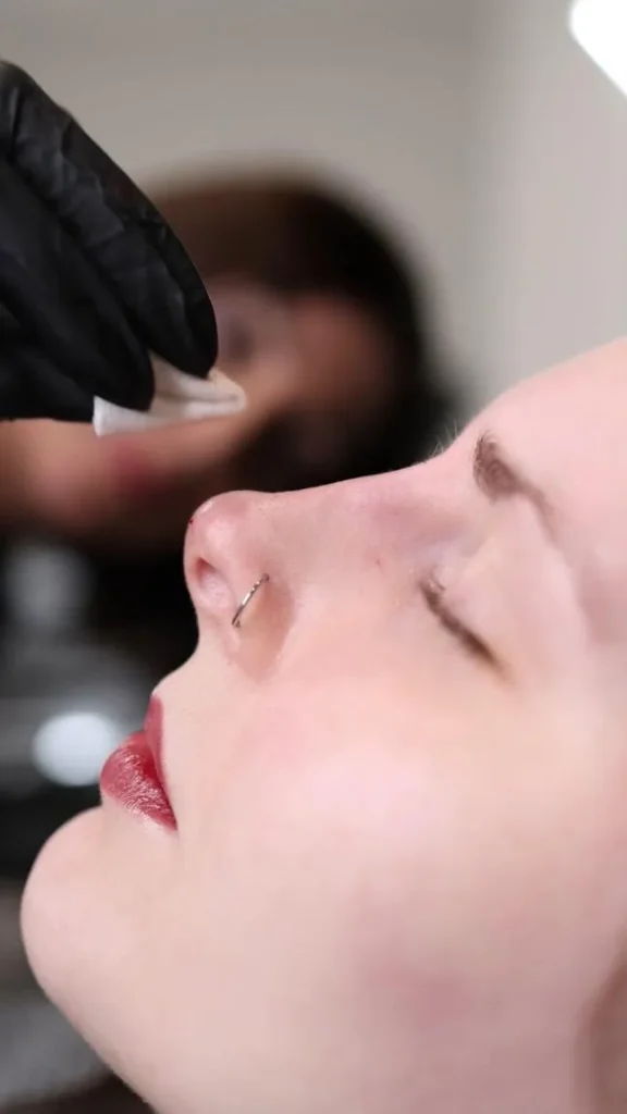 after rhinoplasty