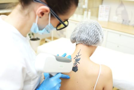 cosmetologist removes the tattoo to the patient using a neodymium laser in a modern clinic. Hardware